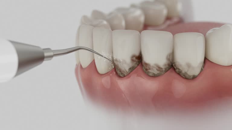 Reliable Emergency Dentist contractor in Flora, IL by Smile Center Dentistry